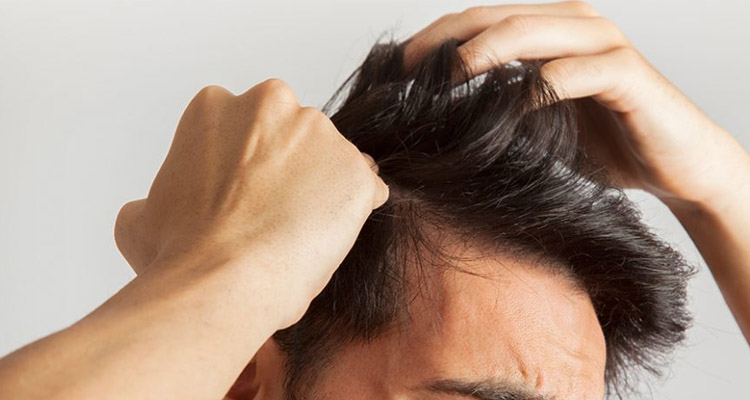 راه‌های کمک به درمان ریزش مو